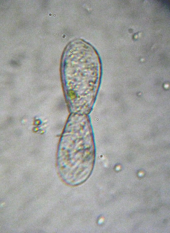 Euglypha cfr laevis ovvero... il bacio